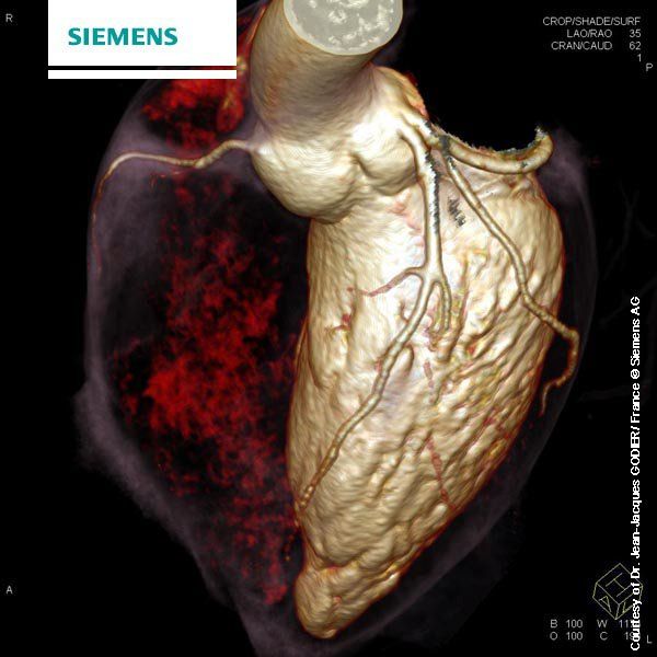 What is the diagnosis? Diff Dx? Tx? Answer = buff.ly/gosYNlC