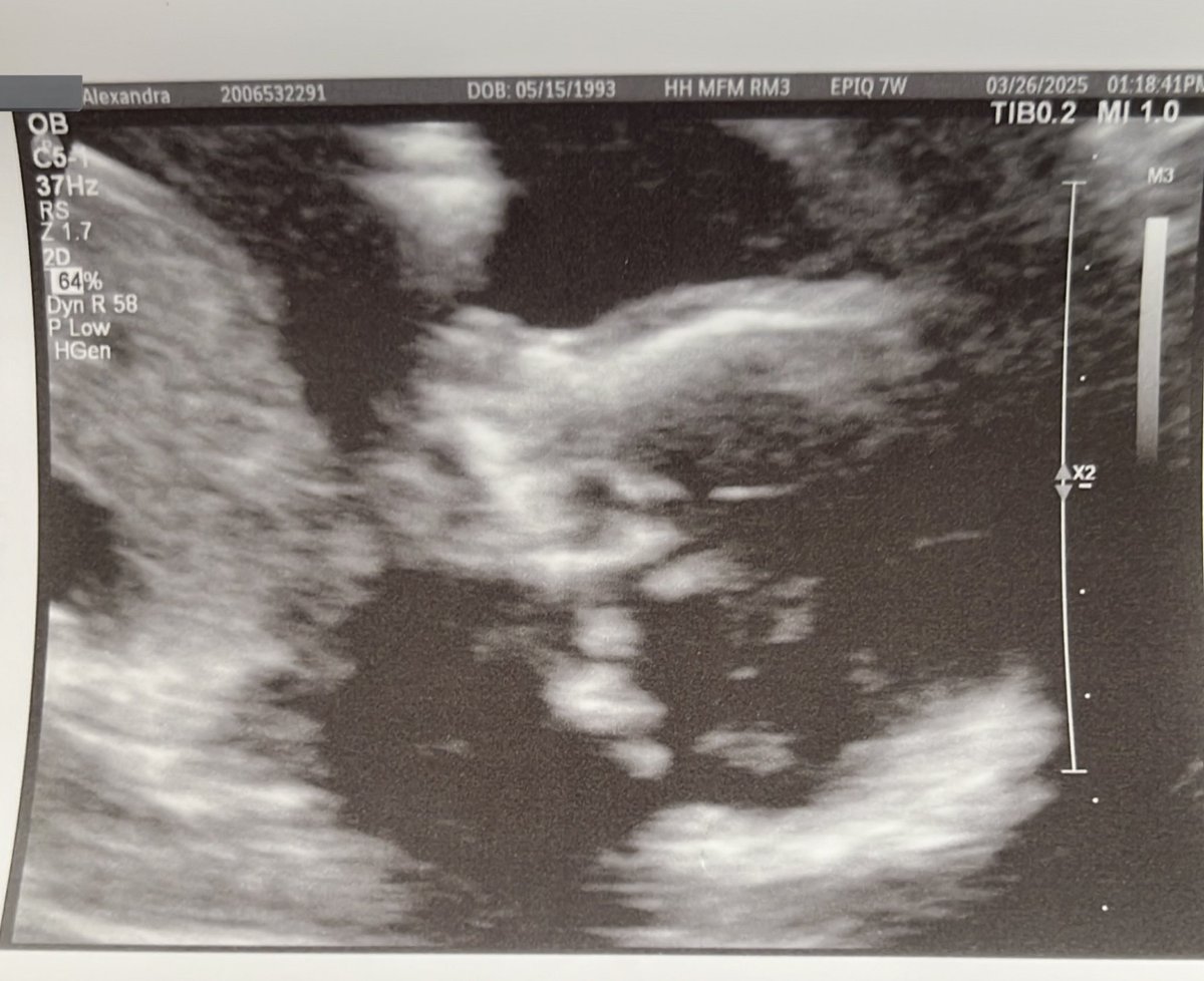 We can’t wait to meet you our sweet baby boy 🩵