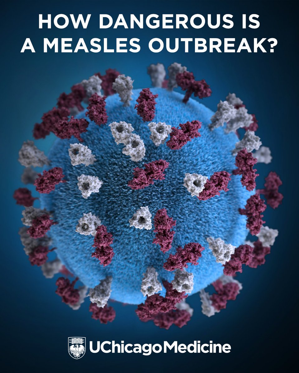 Measles is very contagious and dangerous — but it’s also preventable. Get the facts about the MMR vaccine from a UChicago Medicine infectious diseases specialist. uchicagomedicine.org/forefront/pedi…