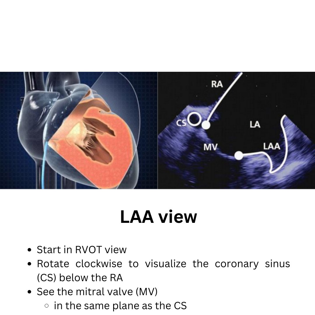 10 ICE Views Every #EPeeps Must Know 🫀👨‍🎓 

👉epcinre.sk/en/10-ice-view…

#echofirst #CardioED #AFib #CINRE #epCINRE