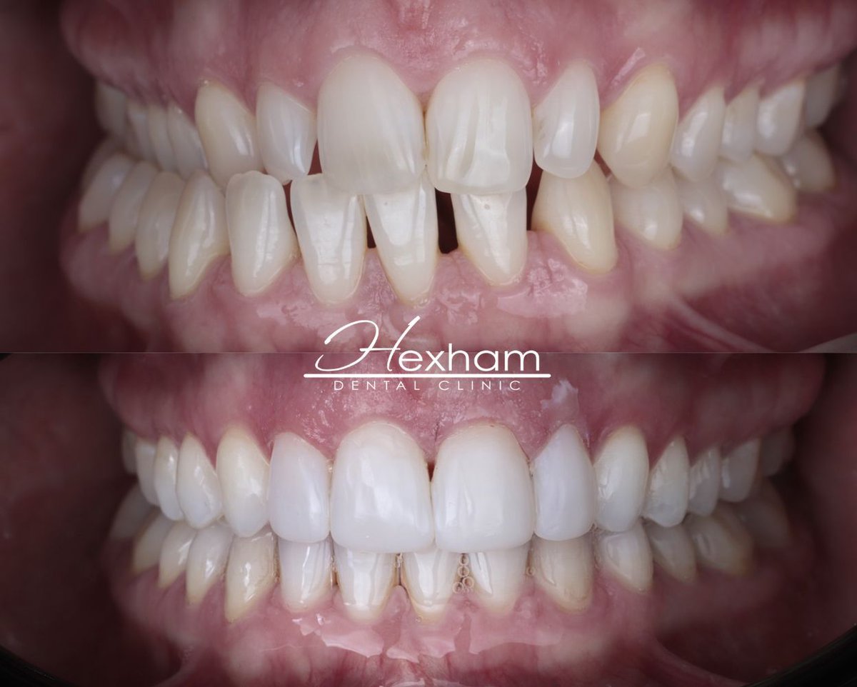 Hexham Dental Clinic (@hexhamdental) on Twitter photo 