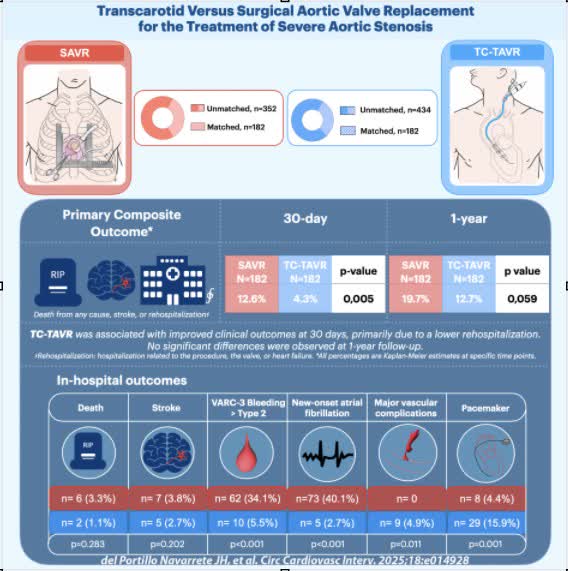 CircInterventions (@circintv) on Twitter photo Is transcarotid TAVR a suitable alternative to SAVR in unsuitable transfemoral access? Transcarotid versus surgical aortic valve replacement for severe AS <a href="/MAvvedimento/">Marisa Avvedimento</a> @delportilloJH <a href="/sidmengi_dr/">Sid Mengi, MD, MRCP</a> <a href="/pedro_cepas/">Pedro Cepas</a> #AHAJournals ahajrnls.org/4iCJPEU Is transcarotid TAVR a suitable alternative to SAVR in unsuitable transfemoral access? Transcarotid versus surgical aortic valve replacement for severe AS <a href="/MAvvedimento/">Marisa Avvedimento</a> @delportilloJH <a href="/sidmengi_dr/">Sid Mengi, MD, MRCP</a> <a href="/pedro_cepas/">Pedro Cepas</a> #AHAJournals ahajrnls.org/4iCJPEU