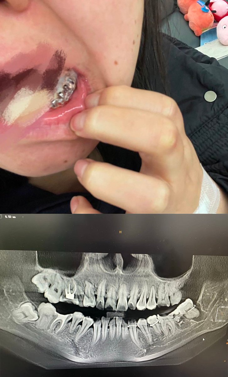 李老师不是你老师 tweet media