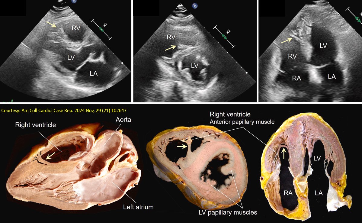 NephroPOCUS tweet media