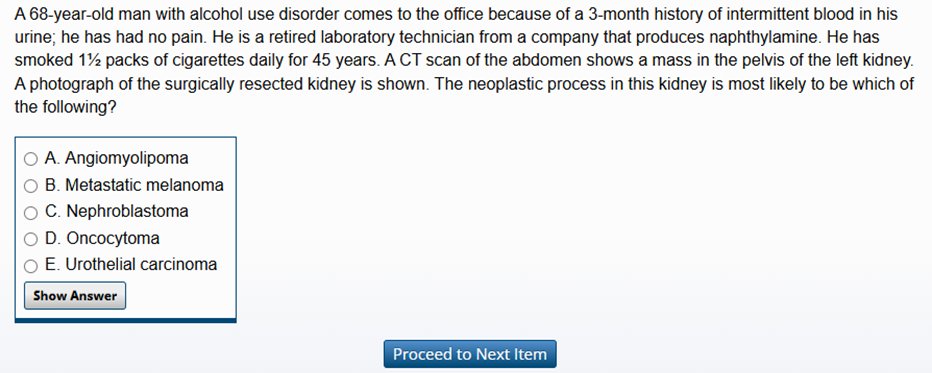 A common trick in USMLE questions is to use alternative words/terms for a disease process. Did you know that bladder cancer is also called transitional cell carcinoma and urothelial carcinoma? A student who only knows one of these names might get this question wrong. Make sure to