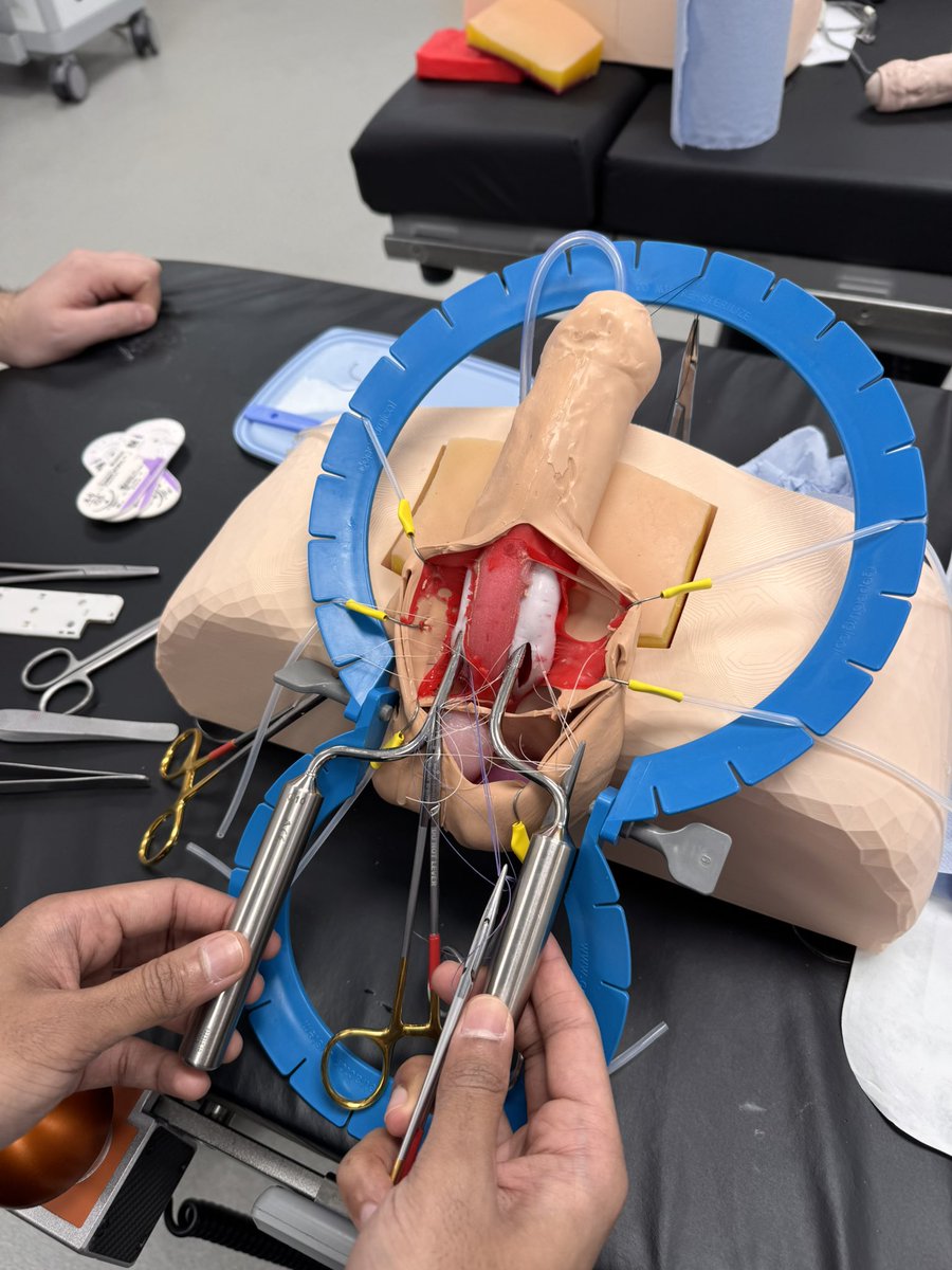 Fabio Castiglione (@castiglionfabio) on Twitter photo 🚀 Exciting day at <a href="/KingsCollegeLon/">King's College London</a> ! We successfully tested our new 3D penile prosthesis model!
Huge thanks to the <a href="/Coloplast_UK/">Coloplast UK & Ireland</a> & our registrars for their dedication.
King’s is solidifying its place as a center of excellence in penile prosthetics. <a href="/kingsandrology/">king’s Andrology</a> 🚀 Exciting day at <a href="/KingsCollegeLon/">King's College London</a> ! We successfully tested our new 3D penile prosthesis model!
Huge thanks to the <a href="/Coloplast_UK/">Coloplast UK & Ireland</a> & our registrars for their dedication.
King’s is solidifying its place as a center of excellence in penile prosthetics. <a href="/kingsandrology/">king’s Andrology</a>