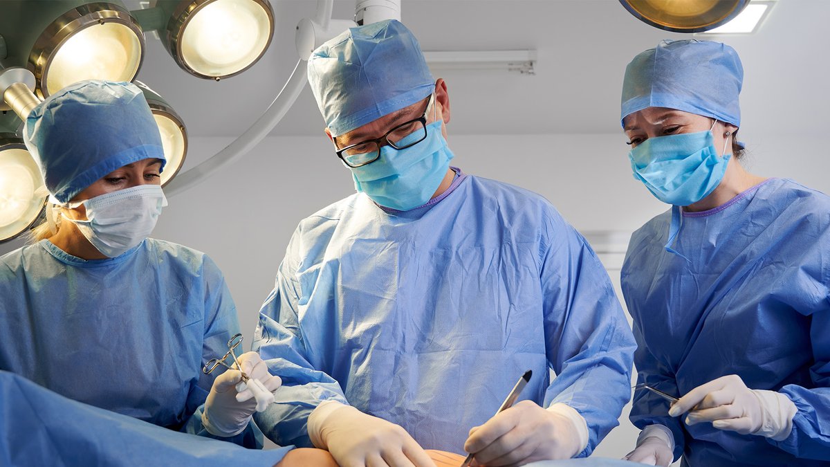 Minimally Invasive Esophagectomy After Permanent Dual Esophageal Stent Placement 

This video shows the case of an MIE for stage III GE junction adenocarcinoma following permanent dual esophageal stent placement. <a href="/alison_baskin/">Alison Baskin</a> <a href="/katemanee95/">Katemanee Burapachaisri</a> <a href="/JVelottaMD/">Jeffrey Velotta MD FACS</a> 

🔗ow.ly/1alb50VkbfW