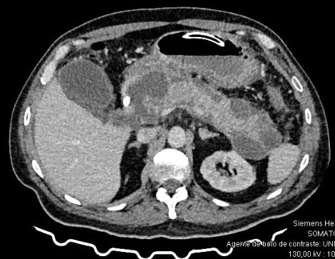 Leonardo Perales tweet media