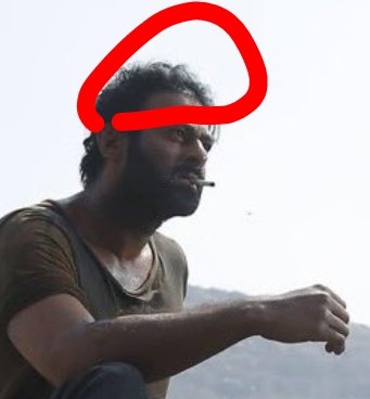 Wig Patch Sarigga Veyyaledha?