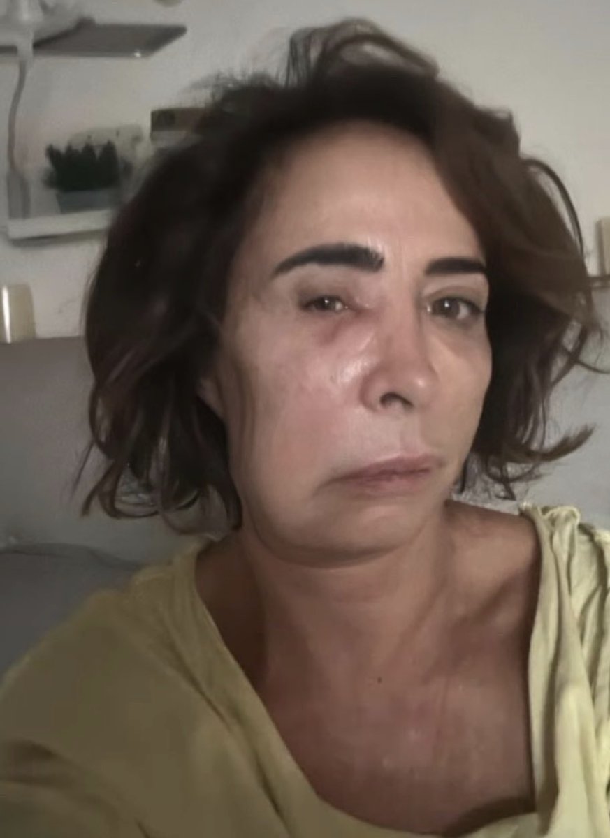 AniMarrashh's tweet photo. El flemón de María Patiño pobreeee https://t.co/49v2fLdlZV