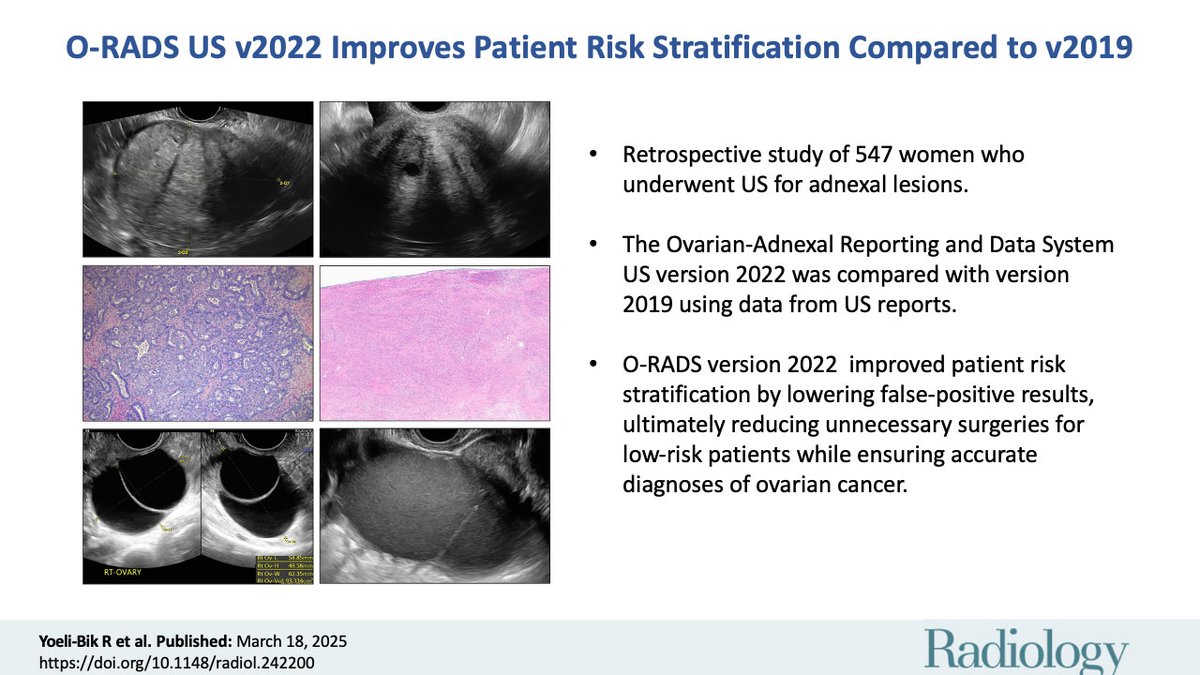 O-RADS US 2022 is a game-changer! It lowers false positives, cuts unnecessary surgeries, and ensures accurate ovarian cancer diagnoses. See how it improves risk stratification. #Radiology #ORADS <a href="/Roni_YoeliBik/">Roni Yoeli-Bik</a> <a href="/Jacquesdeparis1/">Jacquesdeparis</a> <a href="/GeneticWhisper/">Genetic Whisperer</a> <a href="/ErnstLengyel/">Ernst Lengyel</a>
pubs.rsna.org/doi/10.1148/ra…