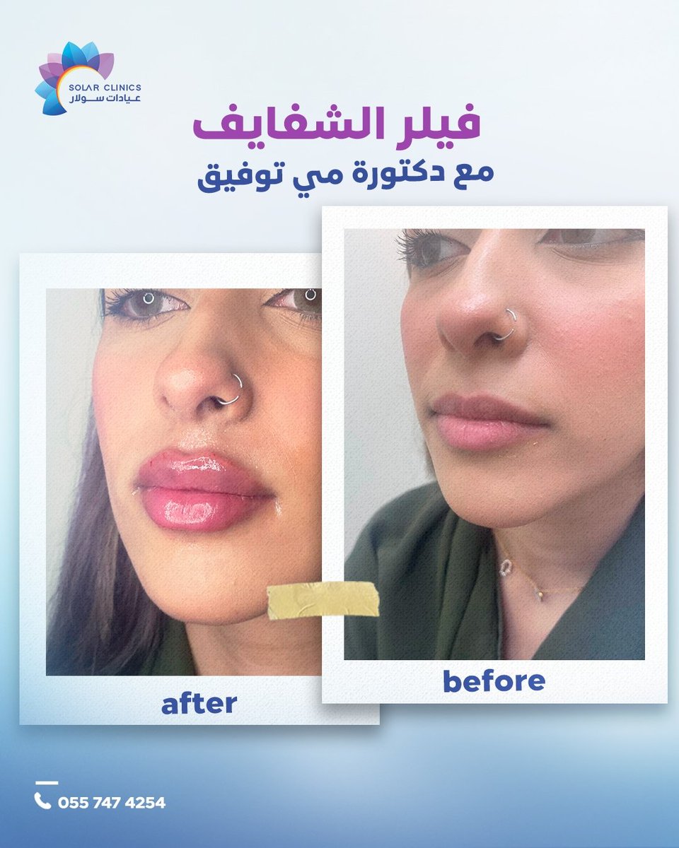 عيادات سولار Solar Clinics tweet media