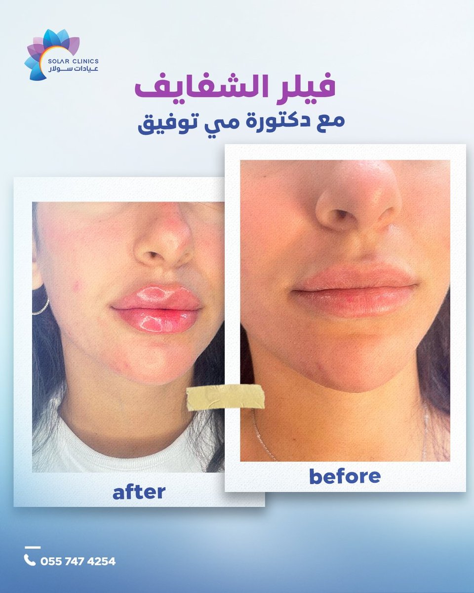 عيادات سولار Solar Clinics tweet media