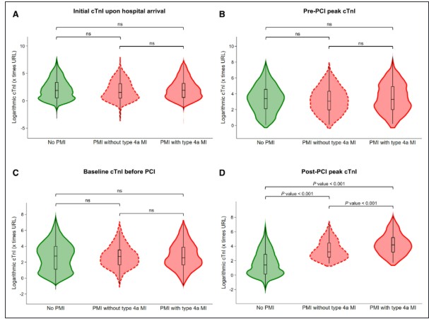 Circulation (@circaha) on Twitter photo Post-PCI Myocardial Injury and Infarct in NSTEMI @matteo_armi <a href="/L_Bergamaschi/">Luca Bergamaschi</a> <a href="/P_Paolisso/">Pasquale Paolisso</a> <a href="/belmontemarta1/">Marta Belmonte</a> <a href="/FoaAlberto/">Alberto Foà</a> <a href="/pizzi_carmine/">Carmine Pizzi</a> <a href="/Unibo/">Università di Bologna</a> ahajournals.org/doi/full/10.11… Post-PCI Myocardial Injury and Infarct in NSTEMI @matteo_armi <a href="/L_Bergamaschi/">Luca Bergamaschi</a> <a href="/P_Paolisso/">Pasquale Paolisso</a> <a href="/belmontemarta1/">Marta Belmonte</a> <a href="/FoaAlberto/">Alberto Foà</a> <a href="/pizzi_carmine/">Carmine Pizzi</a> <a href="/Unibo/">Università di Bologna</a> ahajournals.org/doi/full/10.11…