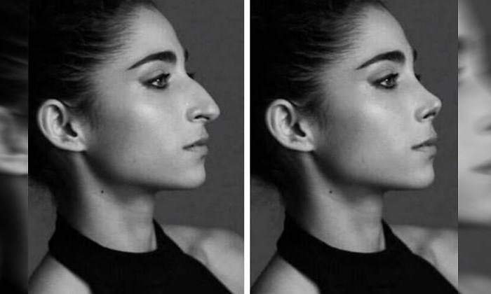 tremenduca's tweet image. Dios bendiga las narices grandes que hacen que los rostros pasen de anodinos a con personalidad. Todos ellos con una rinoplastia serían más normativos y atractivos y más irrelevantes y olvidables.