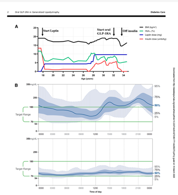 The interest in exploring therapeutic roles for GLP-1RAs  in rare conditions continues with a report on a single individual with generalized lipodystrophy on oral semaglutide enabling discontinuation of high dose #insulin therapy #insulin resistance diabetesjournals.org/care/article/d…