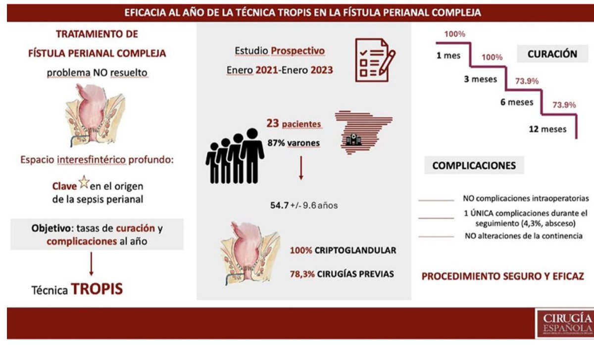 “Resultados al año de la técnica #TROPIS en el tratamiento de la #fístula anal compleja”

<a href="/aecirujanos/">aecirujanos</a> <a href="/coloproctoaec/">Coloproctología-AEC</a> <a href="/me4_so/">SoMe4Surgery</a> <a href="/drfdelaportilla/">Fernando de la Portilla</a> <a href="/AECP_FAECP/">AECP</a> 

🔗elsevier.es//es-revista-ci…