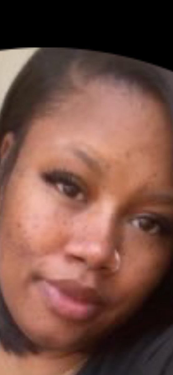 DatboyLynch's tweet photo. @BigWagonKayy @Tr00peRR 😂 ok crater face https://t.co/2MXNfPXKdo