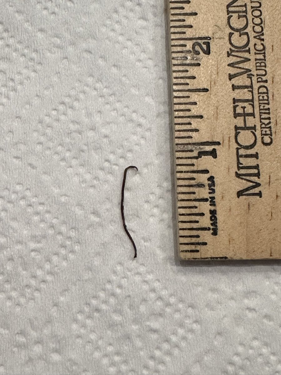 mrstoe's tweet photo. @Boars_Head - so we decided to give you guys another try and bought corned beef brisket for St Patrick’s Day meal this year (since I always had bought yours in the past). While eating some leftovers, I found this hard thing in the meat. Wth is this?? https://t.co/uC8TcnfUo4