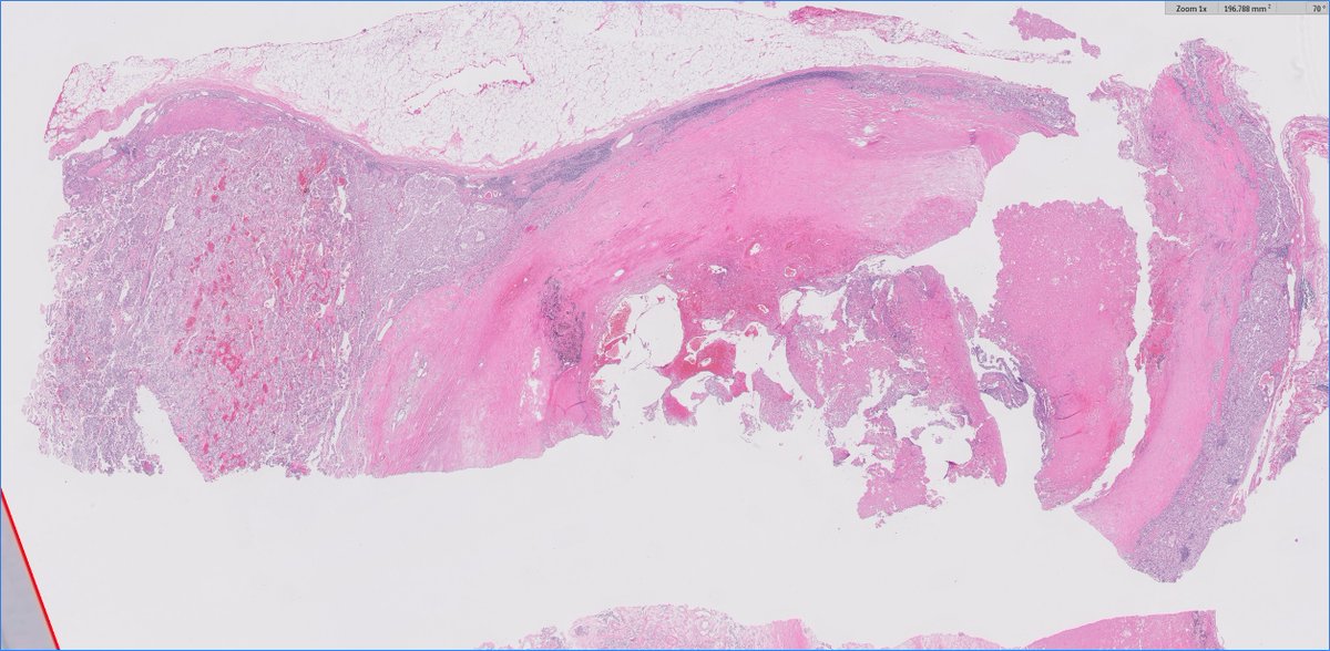 Ankur Sangoi tweet media