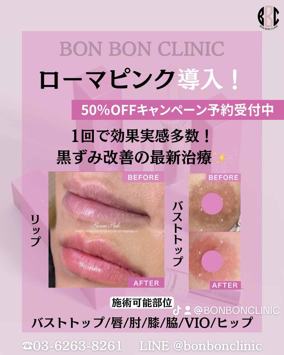 Roma Pink アフタークリームシルバーバストトップ専用 黒ずみメラニン除去の救世主｜ローマピンク