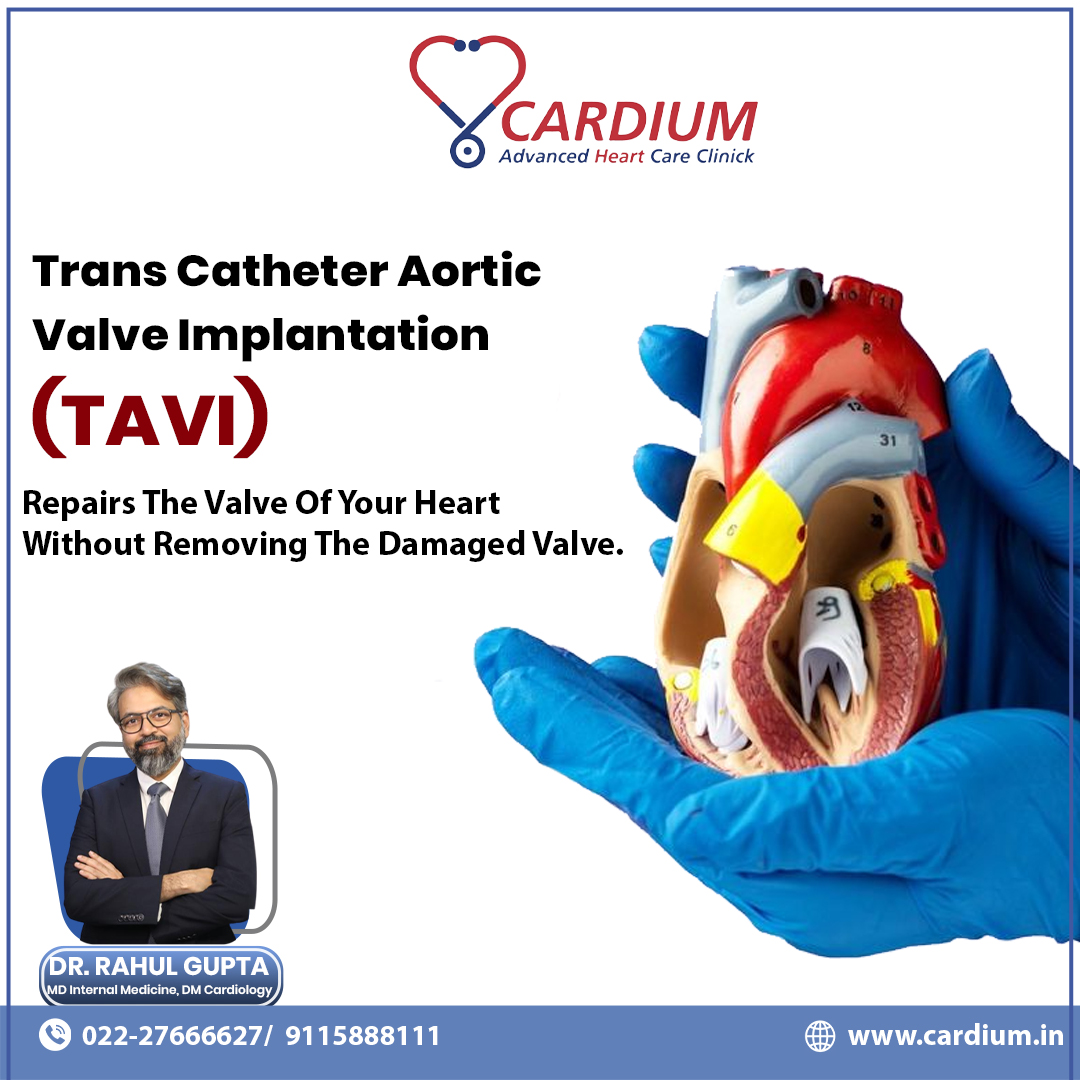 CardiumCare's tweet image. ❤️ Transforming heart care with TAVI – a minimally invasive procedure that repairs your valve without removing the damaged one. 🌟💓

🌏cardium.in

#TAVI #CardiumAdvancedHeartCareClinic #Cardium #cardiologist #heartspecialist #DrRahulGupta #kharghar #vashi #newmumbai