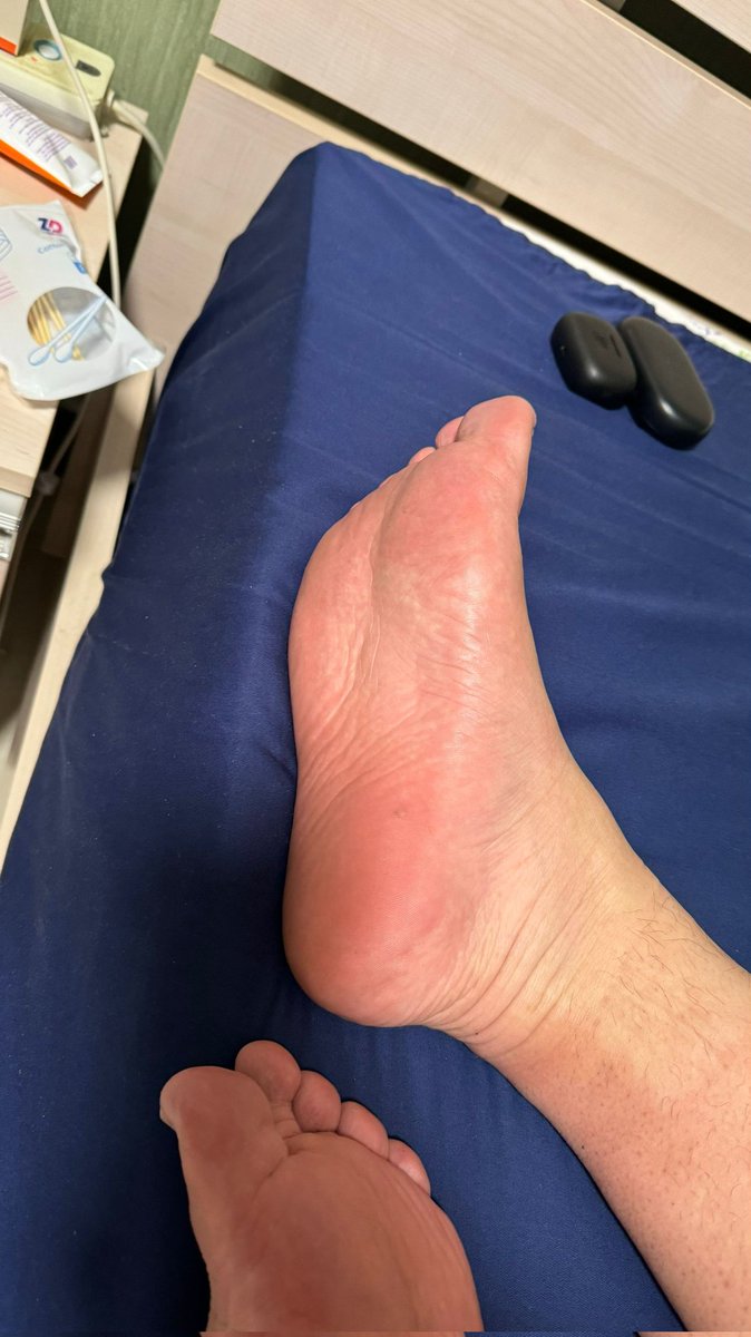 Thursdaytorelax's tweet photo. 出门之前和回来拍的，走了一天脚掌好红 https://t.co/tP9LPsol64