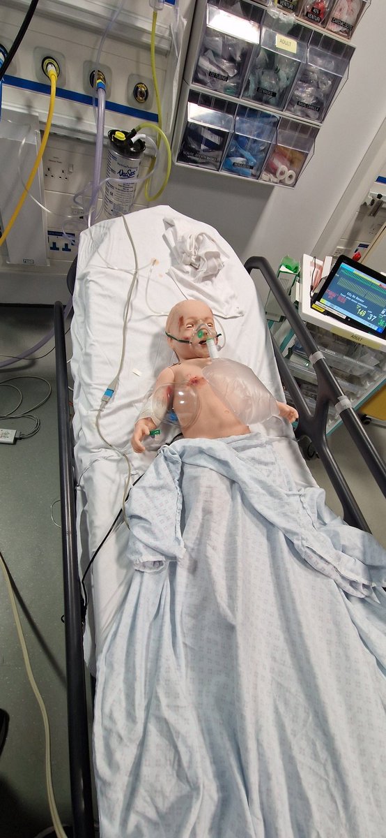 Simulation Tech Drew (@simtechdrew) on Twitter photo Todays A+E in-situ simulation was a child presenting with lethargy, multiple bruises on different stages of healing. Parent reports the child had a "fall" 2 days ago. Evidence of multiple rib fractures. Well done to the team involved. <a href="/QEMedEducation/">QE Gateshead Medical Education</a> <a href="/Gateshead_NHS/">Gateshead Health NHS Foundation Trust</a> <a href="/NEsimulation/">NEsimulation</a> Todays A+E in-situ simulation was a child presenting with lethargy, multiple bruises on different stages of healing. Parent reports the child had a "fall" 2 days ago. Evidence of multiple rib fractures. Well done to the team involved. <a href="/QEMedEducation/">QE Gateshead Medical Education</a> <a href="/Gateshead_NHS/">Gateshead Health NHS Foundation Trust</a> <a href="/NEsimulation/">NEsimulation</a>