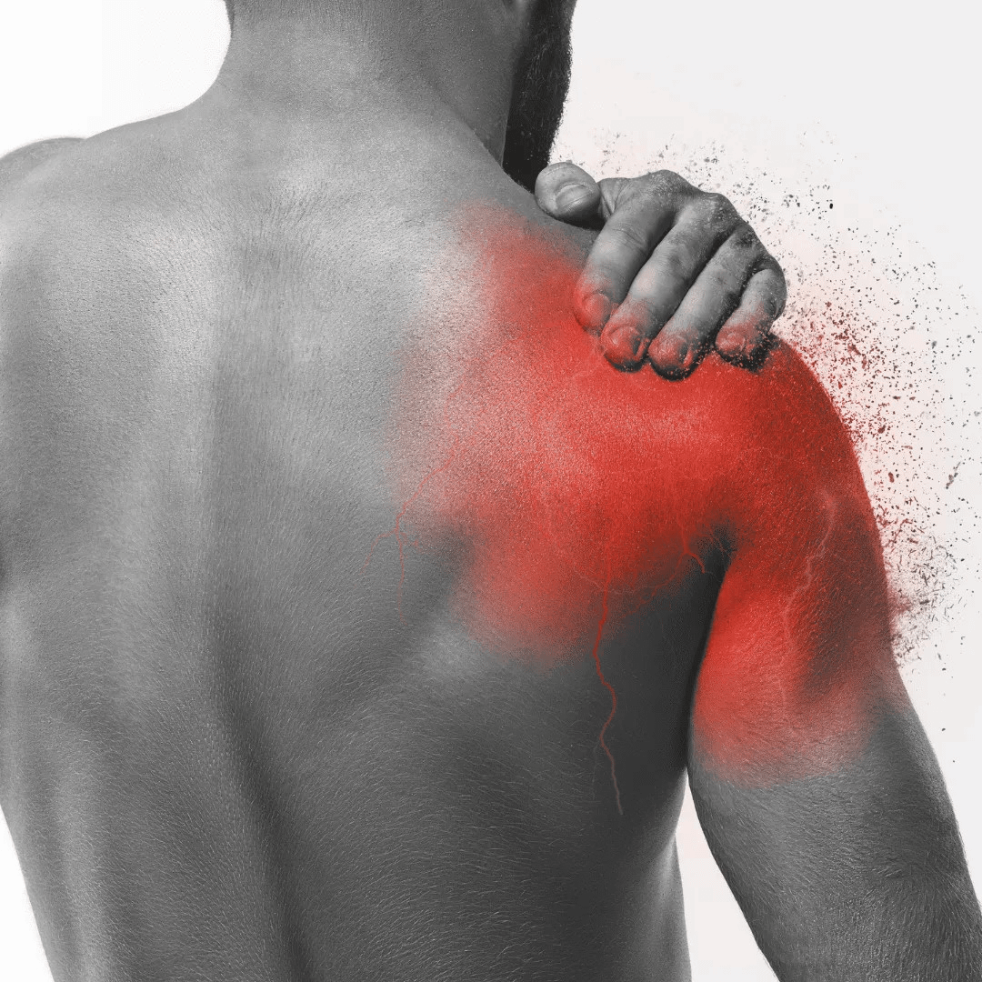 LeddyLLC's tweet photo. The most overworked, painfully tight, yet widely neglected muscle in your body:

The subscapularis.

It's why your shoulders feel locked, your mobility sucks, and even putting on a shirt is a struggle.

Here's what went wrong &amp; how to fix it (science-backed)🧵 https://t.co/NN4Xg9Ww3U