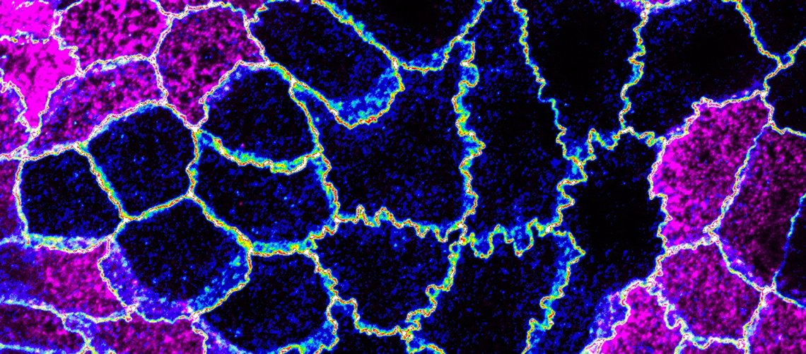 Biologie - UNIGE (@biologie_unige) on Twitter photo Congratulations <a href="/SandraCiti_Lab/">Citi Lab</a>
for your latest publication in <a href="/NatureComms/">Nature Communications</a>
A feedback circuitry involving γ-actin, β-actin and nonmuscle myosin-2 A controls #tight #junction and apical cortex mechanics unige.ch/medias/en/2025… <a href="/MoCel_Geneva/">Molecular & Cellular Biology Dept 🔬 Geneva 🇨🇭</a>
<a href="/sciences_UNIGE/">Faculty of Science | UNIGE</a> Congratulations <a href="/SandraCiti_Lab/">Citi Lab</a>
for your latest publication in <a href="/NatureComms/">Nature Communications</a>
A feedback circuitry involving γ-actin, β-actin and nonmuscle myosin-2 A controls #tight #junction and apical cortex mechanics unige.ch/medias/en/2025… <a href="/MoCel_Geneva/">Molecular & Cellular Biology Dept 🔬 Geneva 🇨🇭</a>
<a href="/sciences_UNIGE/">Faculty of Science | UNIGE</a>