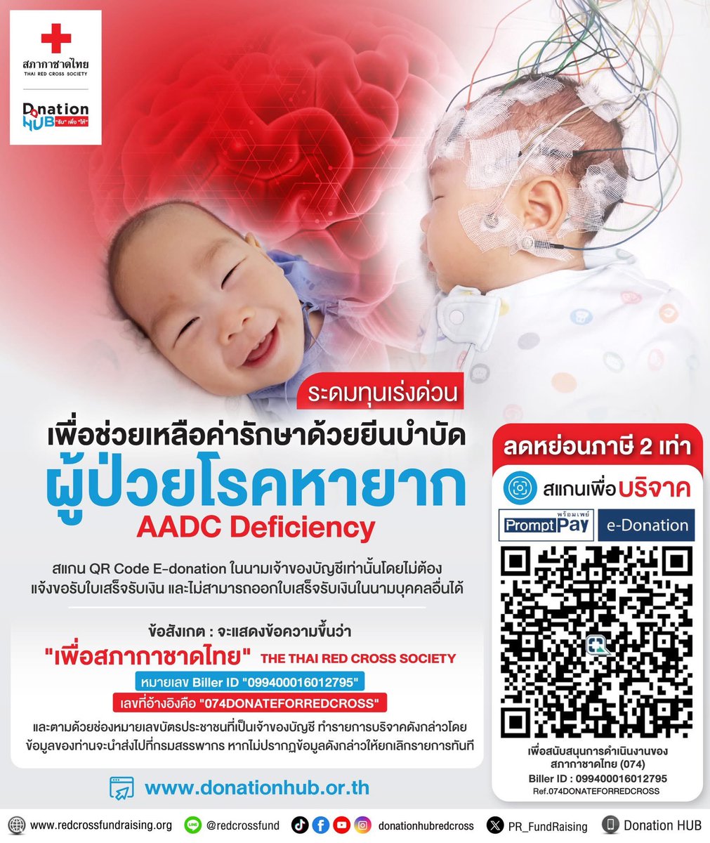 #ทุกบาทของท่าน คือความหวังของผู้ป่วยเด็กน้อยที่น่าสงสาร ที่อยากลุกขึ้นเดิน อยากเรียกป๊าม๊าด้วยเสียงตัวเอง อยากกินขนมอร่อยๆ อยากนอนหลับฝันดีทั้งคืน ได้ไปโรงเรียนวิ่งเล่นกับเพื่อนๆ
.
#ระดมทุนเร่งด่วน เพื่อช่วยเหลือผู้ป่วยโรคหายาก AADC Deficiency