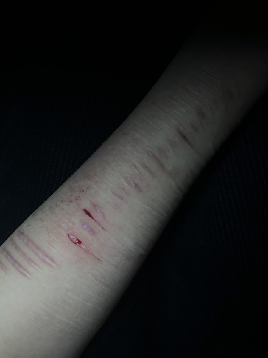 l919_99's tweet photo. #自残 #自傷行為 #自伤 #リスカ  #アムカ #scars https://t.co/vdaX347cZn