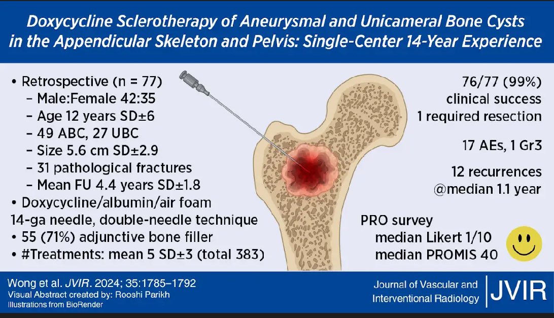 JVIR (@jvirmedia) on Twitter photo Visual abstract by <a href="/RooshiParikh/">Rooshi Parikh</a> on image-guided sclerotherapy of bone cysts from the team <a href="/CincyKidsRad/">Cincy Kids Radiology</a>! Visual abstract by <a href="/RooshiParikh/">Rooshi Parikh</a> on image-guided sclerotherapy of bone cysts from the team <a href="/CincyKidsRad/">Cincy Kids Radiology</a>!