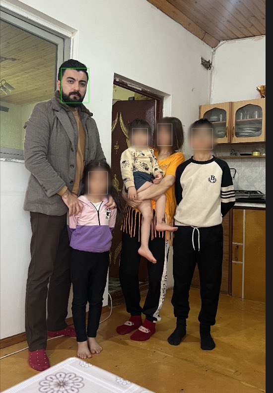 7-ci ailəyə Yardım olundu.
Gunay xanım əri ilə boşanıb. 4 uşaqları var, 1 uşaq əri ilə gedib, daha doğrusu nənəsi baxır. Əri içki aludəçisidi, dövlət aliment ala bilmir adamdan, tuturlar, həbs edirlər xeyri yoxdu. Alkoqolikdi deyir elə mənə də yatmağa yer lazımdı, tutun. 3 uşaq