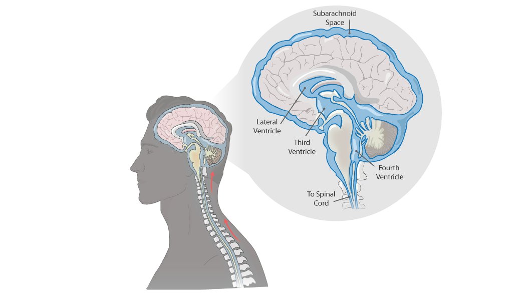 NIBIB (@nibibgov) on Twitter photo Could deep brain stimulation someday be performed without drilling into the skull? <a href="/RiceECE/">Rice Electrical & Computer Engineering</a> & <a href="/utmbhealth/">UTMB Health</a> researchers are developing a preclinical method to access the brain by guiding a catheter through the cerebrospinal fluid. More here: go.nih.gov/CTl1JZ7 Could deep brain stimulation someday be performed without drilling into the skull? <a href="/RiceECE/">Rice Electrical & Computer Engineering</a> & <a href="/utmbhealth/">UTMB Health</a> researchers are developing a preclinical method to access the brain by guiding a catheter through the cerebrospinal fluid. More here: go.nih.gov/CTl1JZ7