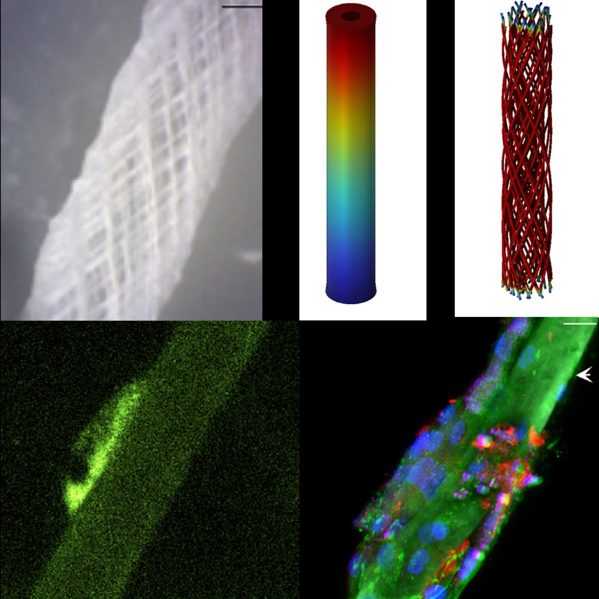 Modelos computacionales, estructuras tubulares, 3D Melt Electrowriting, reproducen prop. t. Aquiles. Tenocitos humanos crecen y se diferencian <a href="/unizar/">Universidad Zaragoza</a> <a href="/CIMA_unav/">Cima Universidad de Navarra</a> <a href="/uchceu/">Universidad CEU UCH</a> doi.org/10.1016/j.actb… Agradecemos financiación <a href="/CienciaGob/">Ministerio de Ciencia, Innovación y Universidades</a>, D Ind Inn <a href="/GobAragon/">Gobierno de Aragón</a> y <a href="/sechc_oficial/">SECHC</a>    s.  .