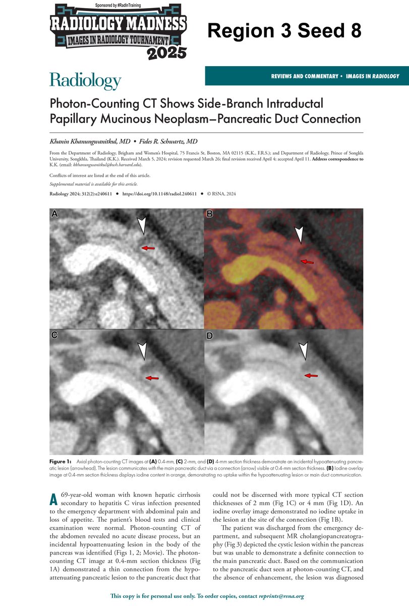 #RadiologyMadness presented by #RadinTraining 

Region 3 First Round Matchup 

Diagnosis 1 vs Diagnosis 8 

VOTE BELOW!