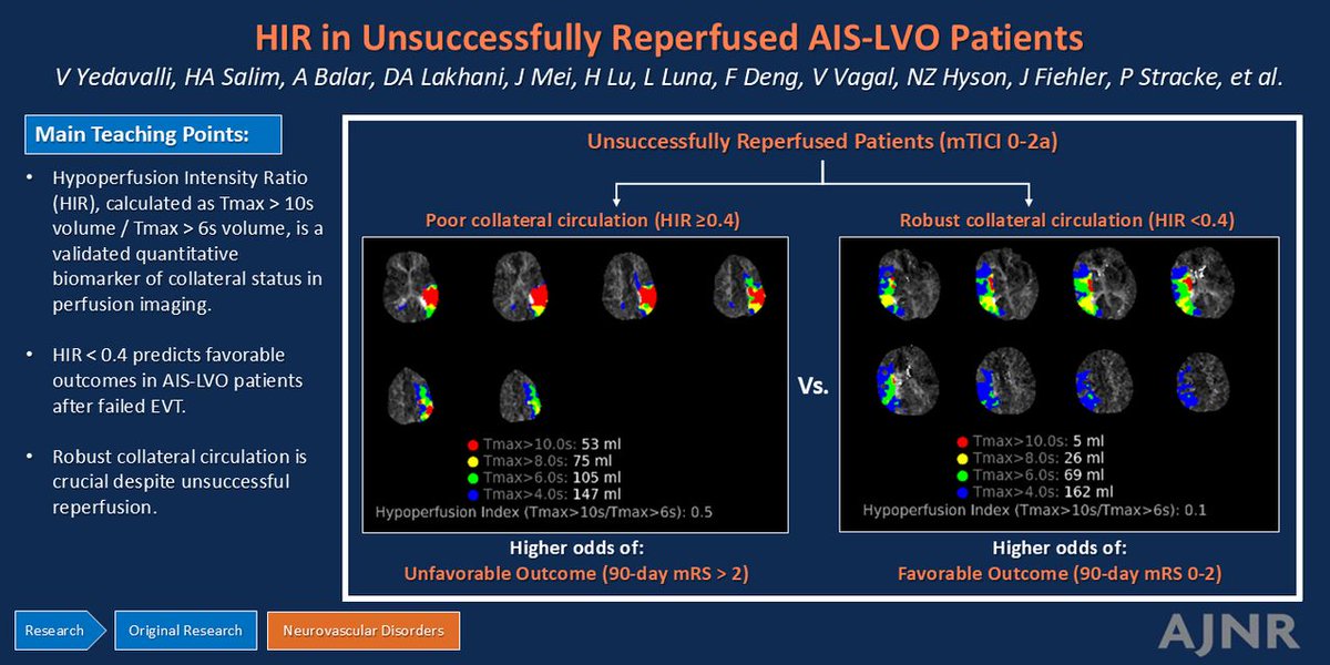 AJNR (@theajnr) on Twitter photo "Hypoperfusion Intensity Ratio Less Than 0.4 Is Associated with Favorable Outcomes in Unsuccessfully Reperfused Acute Ischemic Stroke with Large-Vessel Occlusion"
doi.org/10.3174/ajnr.A…
#HIR #AIS #LVO
<a href="/vsyedavalli/">Vivek Yedavalli, MD, MS, FAHA</a> @YedavaSNAPlab <a href="/Hopkins_Rad/">Johns Hopkins Radiology</a> <a href="/hopkinsneurorad/">Johns Hopkins Neuroradiology</a> <a href="/JeremyHeitMDPHD/">Jeremy Heit, MD, PhD</a> "Hypoperfusion Intensity Ratio Less Than 0.4 Is Associated with Favorable Outcomes in Unsuccessfully Reperfused Acute Ischemic Stroke with Large-Vessel Occlusion"
doi.org/10.3174/ajnr.A…
#HIR #AIS #LVO
<a href="/vsyedavalli/">Vivek Yedavalli, MD, MS, FAHA</a> @YedavaSNAPlab <a href="/Hopkins_Rad/">Johns Hopkins Radiology</a> <a href="/hopkinsneurorad/">Johns Hopkins Neuroradiology</a> <a href="/JeremyHeitMDPHD/">Jeremy Heit, MD, PhD</a>