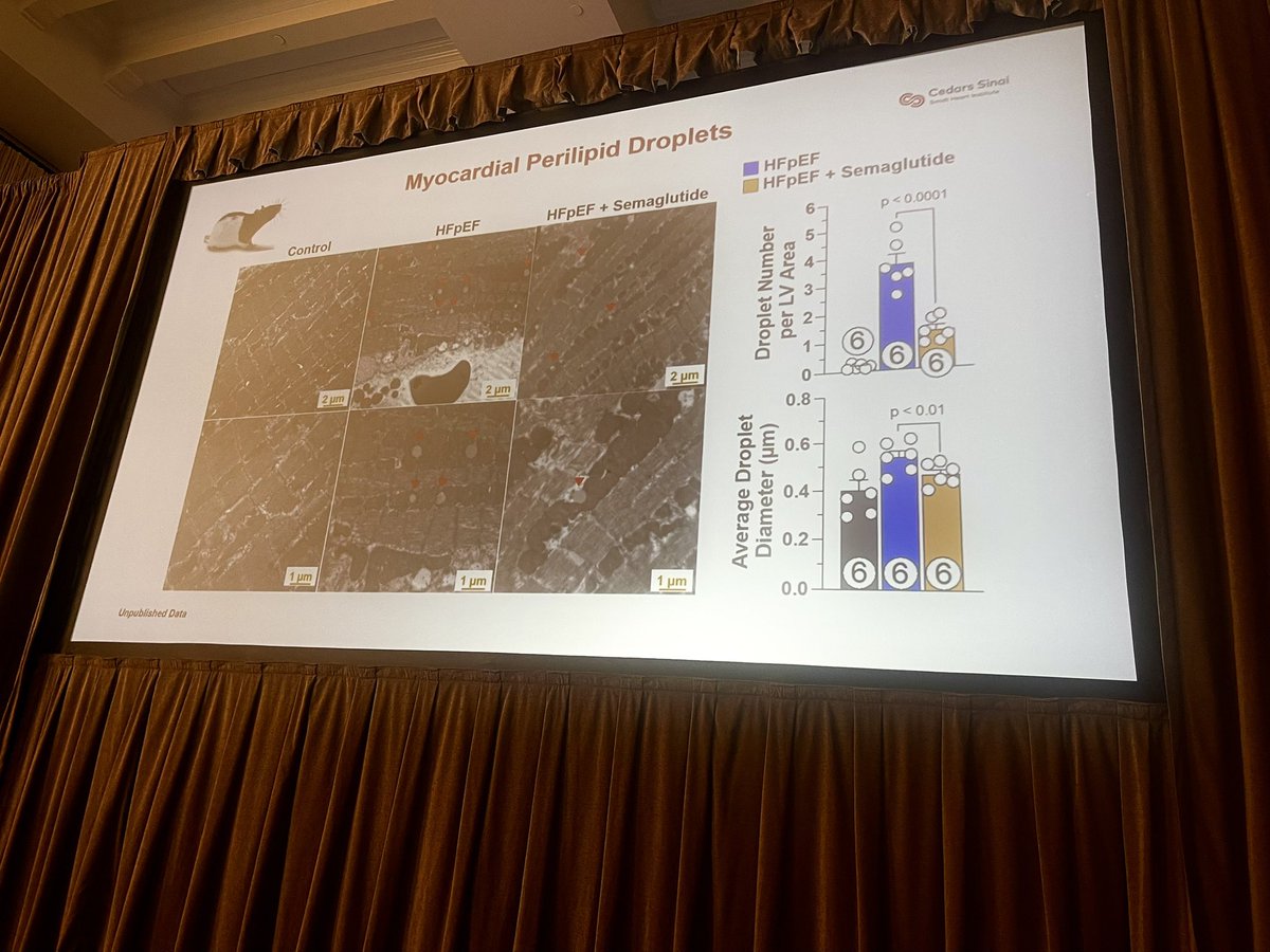 Smidt Heart Institute at Cedars-Sinai (@smidtheart) on Twitter photo Happening now! <a href="/HFpEFSummit/">HFpEF Summit</a> 
Dr. Traci Goodchild sharing data on their study showing the effects of #semaglutide on #HFpEF models. 
#GLP1 Happening now! <a href="/HFpEFSummit/">HFpEF Summit</a> 
Dr. Traci Goodchild sharing data on their study showing the effects of #semaglutide on #HFpEF models. 
#GLP1