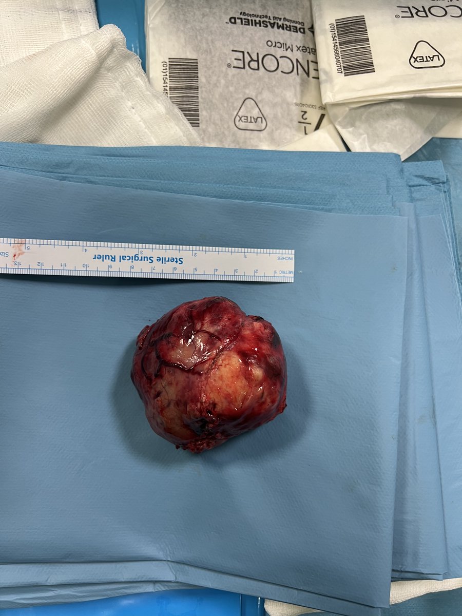 meGursesmd's tweet photo. #BrainTumor
#Neurosurgery
#BrainCancer
#Meningioma
#NeuroOncology
#BrainTumorAwareness
#TumorResearch
#CNSCancer
#PediatricBrainTumor
#BrainTumorSurvivor
#Neuroscience
#CancerResearch
#BrainHealth
#BrainTumorTreatment
#Craniotomy
#SkullBaseSurgery
#BrainTumorSupport https://t.co/gExGSiv5Di