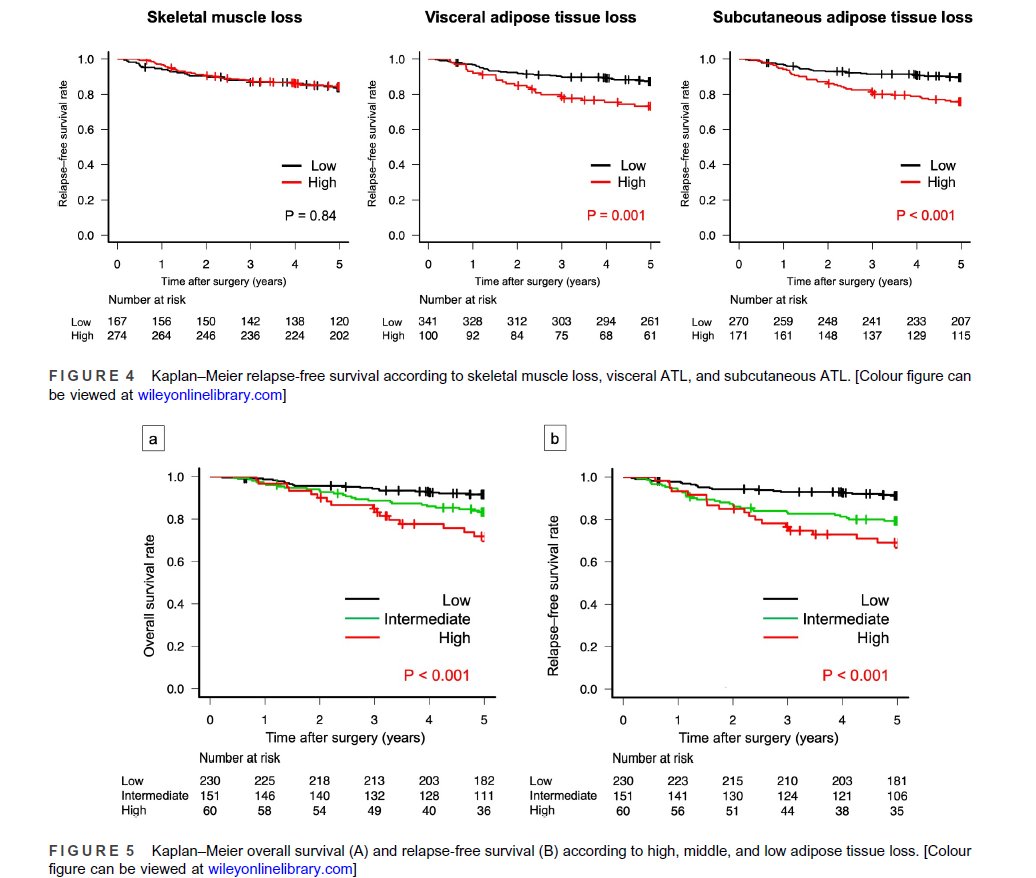 We are proud that our AI-driven body composition analysis software contributed to a recent study in Japan, investigating the prognostic impact of adipose tissue loss after gastric cancer surgery. This highlights the global impact of our technology in advancing medical research.