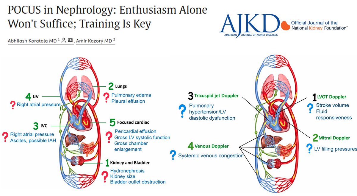 NephroPOCUS (@nephrop) on Twitter photo #MedEd #Nephpearls
Thrilled to co-author this important paper with Prof <a href="/AmirKazory/">Amir Kazory</a>, highlighting the need for proper #POCUS training in #Nephrology. While it's great to see POCUS gaining traction, inadequate skills in image acquisition, interpretation, and clinical integration #MedEd #Nephpearls
Thrilled to co-author this important paper with Prof <a href="/AmirKazory/">Amir Kazory</a>, highlighting the need for proper #POCUS training in #Nephrology. While it's great to see POCUS gaining traction, inadequate skills in image acquisition, interpretation, and clinical integration