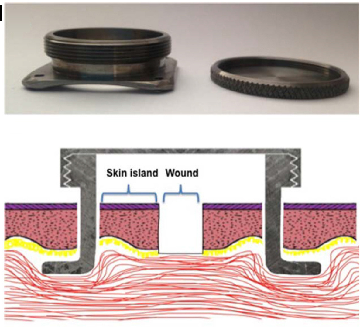 jidinnovations's tweet image. From the March 2025 issue: Improved #splinting for #wound healing models in mice ow.ly/ig1950Unp7S #medderm