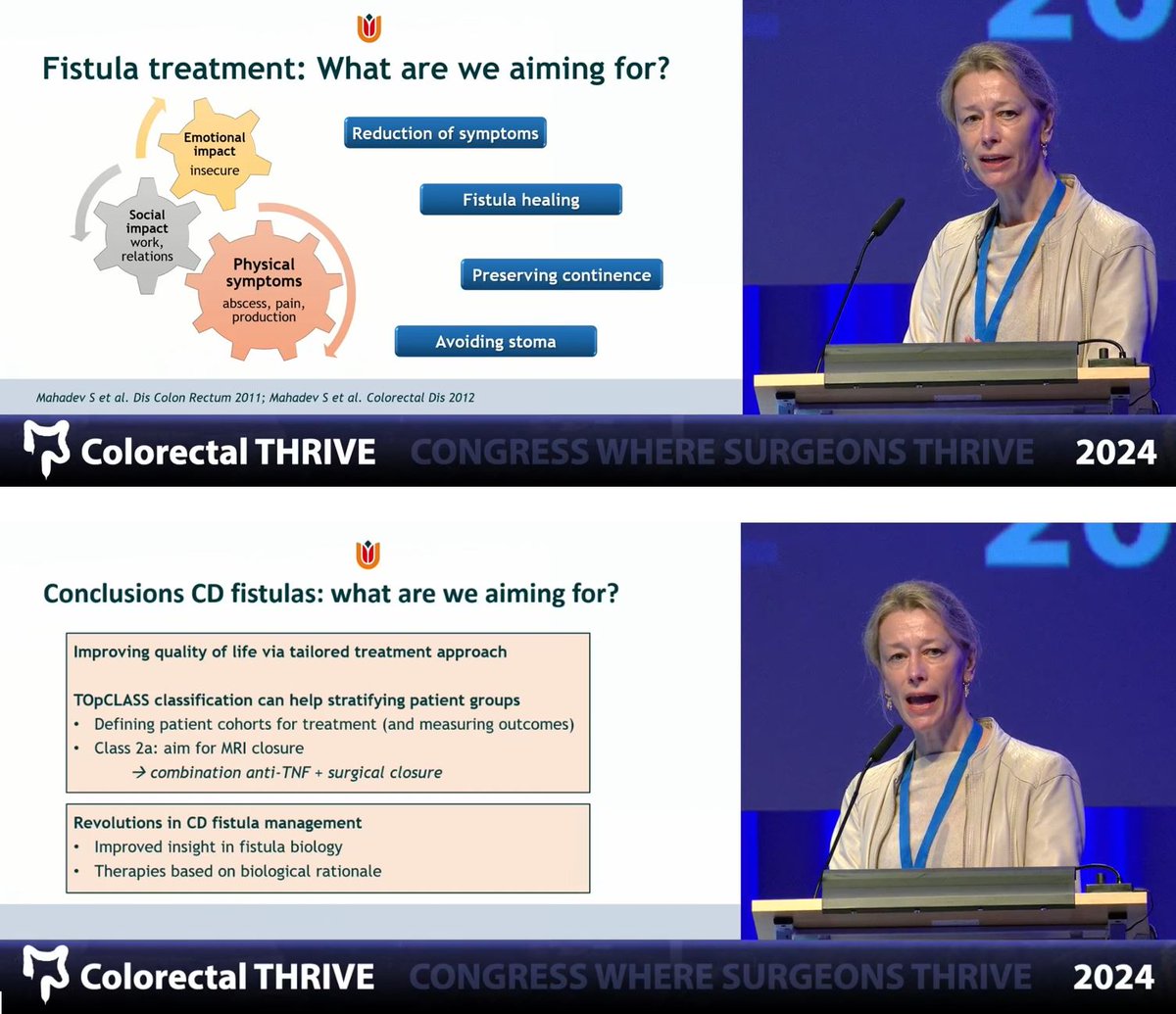 Michel Adamina (@micheladamina) on Twitter photo (R)evolutions in the Management of #Crohn Fistula by Chris Buskens
🔗 colorectal-thrive.org/#free-lectures
Join #THRIVE2025 Sun 30.3 - Wed 2.4.2025
- 70 Expert lectures, single-stream
- Onsite networking + online, on-demand access
- President’s lecture by <a href="/AntoninoSpin/">Antonino Spinelli</a> <a href="/albertoarezzo/">Alberto Arezzo</a> (R)evolutions in the Management of #Crohn Fistula by Chris Buskens
🔗 colorectal-thrive.org/#free-lectures
Join #THRIVE2025 Sun 30.3 - Wed 2.4.2025
- 70 Expert lectures, single-stream
- Onsite networking + online, on-demand access
- President’s lecture by <a href="/AntoninoSpin/">Antonino Spinelli</a> <a href="/albertoarezzo/">Alberto Arezzo</a>