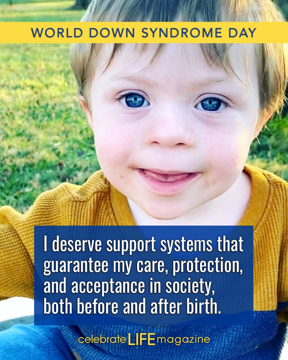 ALL_CL_Magazine's tweet image. Happy World Down Syndrome Day! #improveoursupportsystems

worlddownsyndromeday.org
