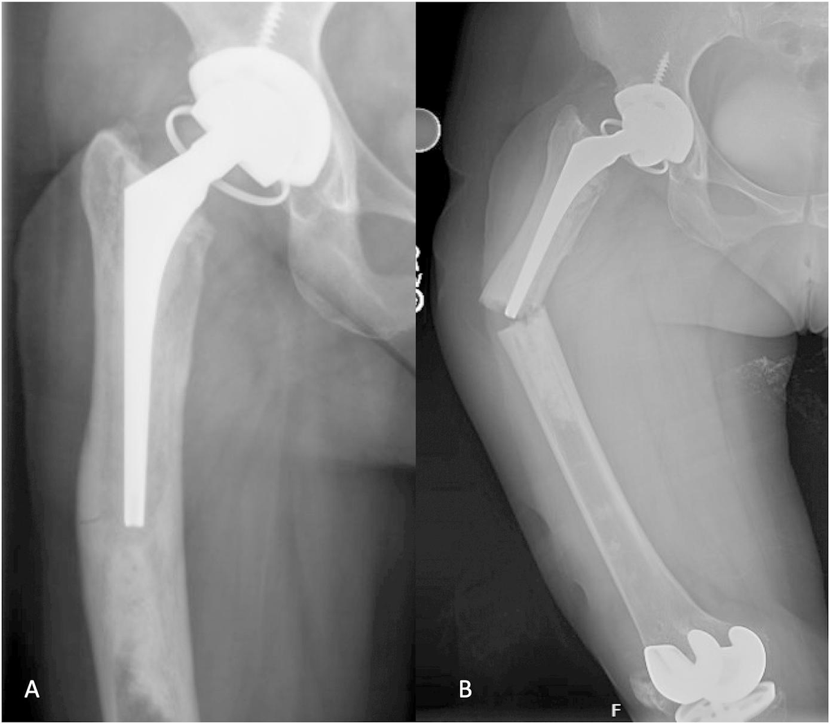 J Bone & Joint Surg tweet media