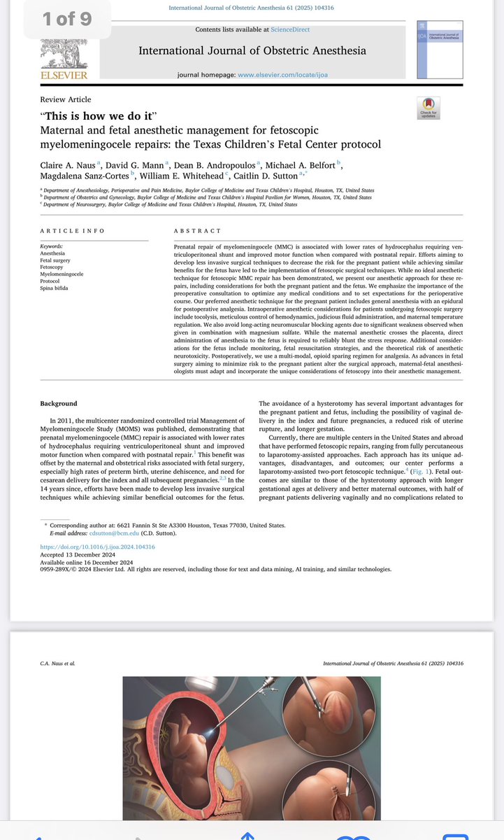 International Journal of Obstetric Anesthesia (@ijoa_journal) on Twitter photo Check ‘this is how we do it’ - review on fetal myelomeningocele repairs by Dr. Sutton from <a href="/TexasChildrens/">Texas Children's</a> & accompanying editorial by Dr. Berman from <a href="/HopkinsACCM/">Johns Hopkins ACCM</a> & <a href="/ruthi_landau/">Dr. Ruthi Landau</a> on disseminating protocols in <a href="/IJOA_Journal/">International Journal of Obstetric Anesthesia</a>
obstetanesthesia.com/article/S0959-…
obstetanesthesia.com/article/S0959-… Check ‘this is how we do it’ - review on fetal myelomeningocele repairs by Dr. Sutton from <a href="/TexasChildrens/">Texas Children's</a> & accompanying editorial by Dr. Berman from <a href="/HopkinsACCM/">Johns Hopkins ACCM</a> & <a href="/ruthi_landau/">Dr. Ruthi Landau</a> on disseminating protocols in <a href="/IJOA_Journal/">International Journal of Obstetric Anesthesia</a>
obstetanesthesia.com/article/S0959-…
obstetanesthesia.com/article/S0959-…