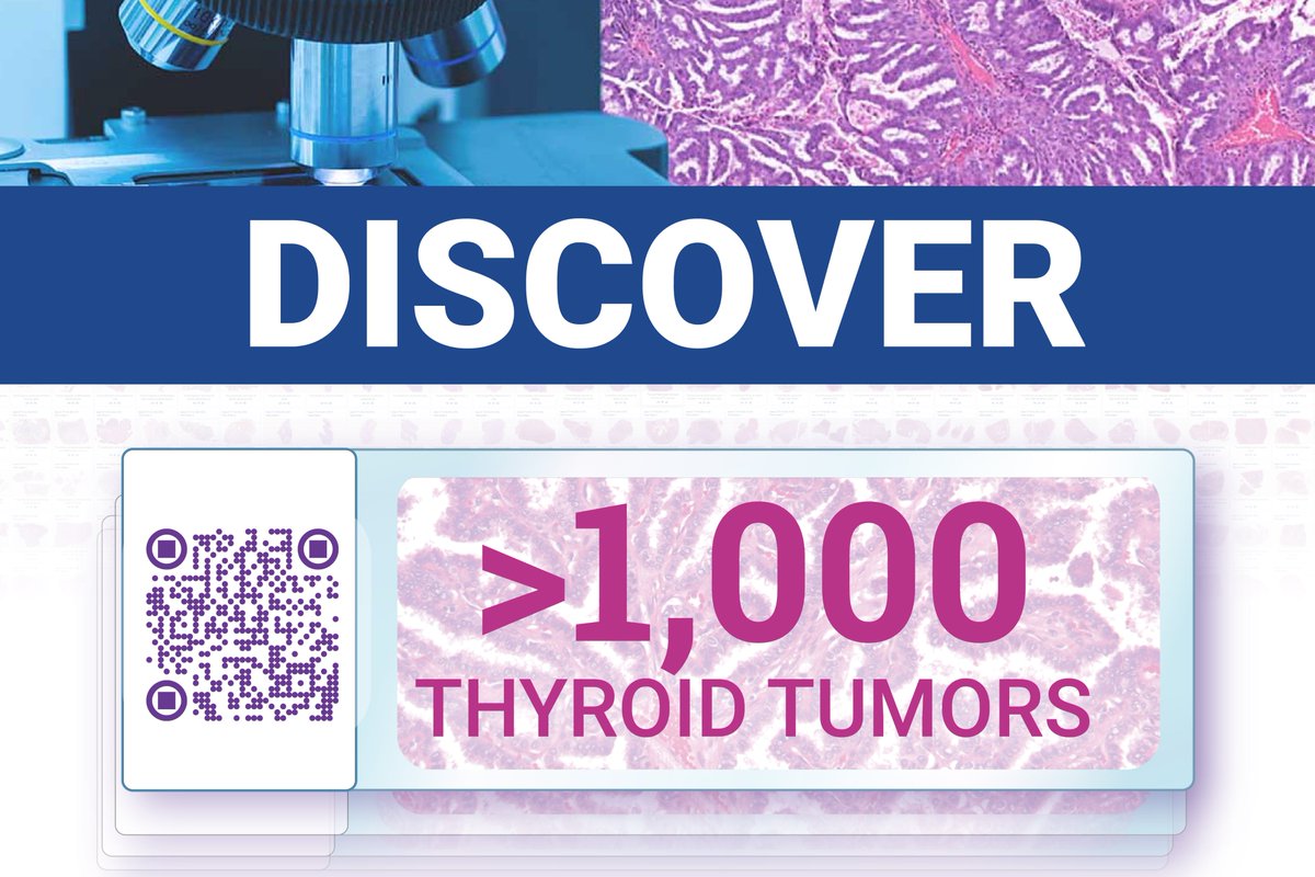 We are thrilled to announce that the World Tumor Registry has reached a milestone of 1,000 posted thyroid tumor cases from all over the world!
#WTR #DigitalPathology #Thyroid