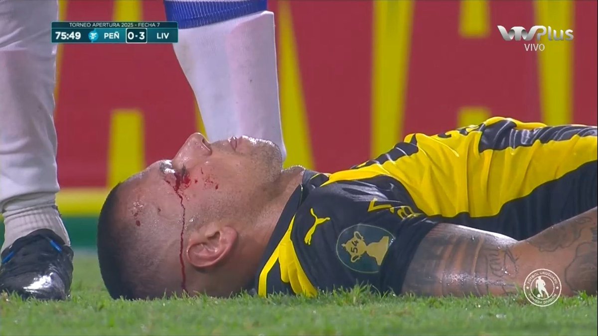 patronmanya's tweet photo. cada vez que veo un partido de este Peñarol termino asi: https://t.co/K0fuFaslFC