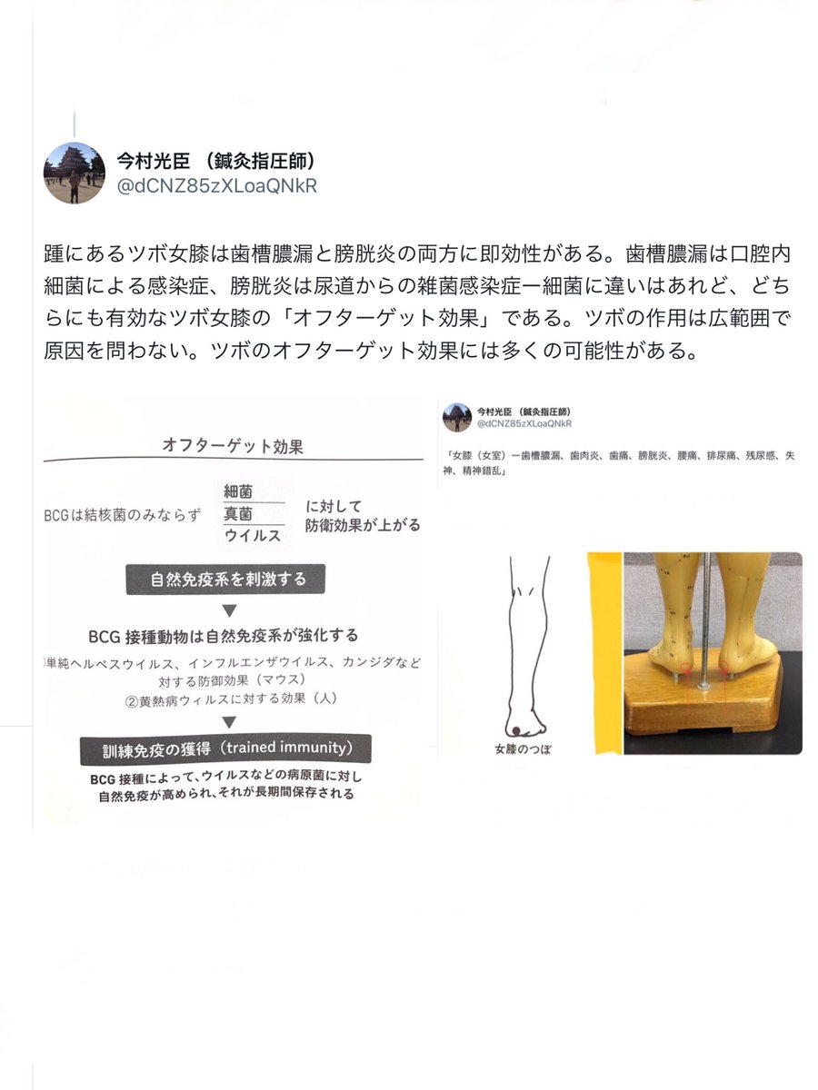 実は私はもうずっとジョシツに灸を続けてきている。最初は歯の痛みなんかを治す目的だったが、それはほぼ制圧できた。膀胱炎はないが、寒くなると尿意を催す頻度は上がる。あるいは夜間にオシッコで起きる。このへんも支配下においている。しかし🔥ジョシツ灸🔥で私が狙っているのはアンチエイジング↓